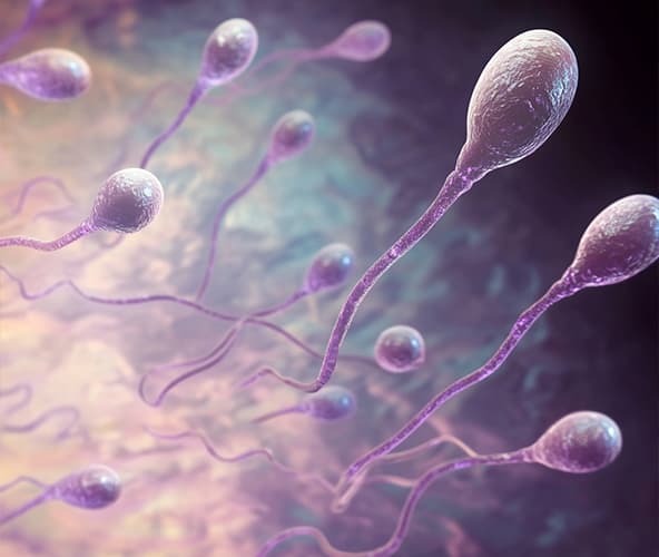 Sperm dysfunction