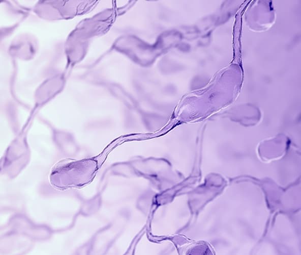 Sperm dysfunction