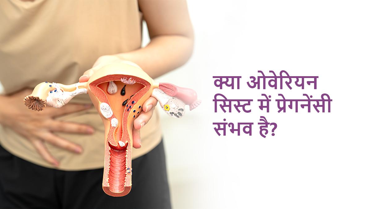क्या ओवेरियन सिस्ट में प्रेगनेंसी संभव है?