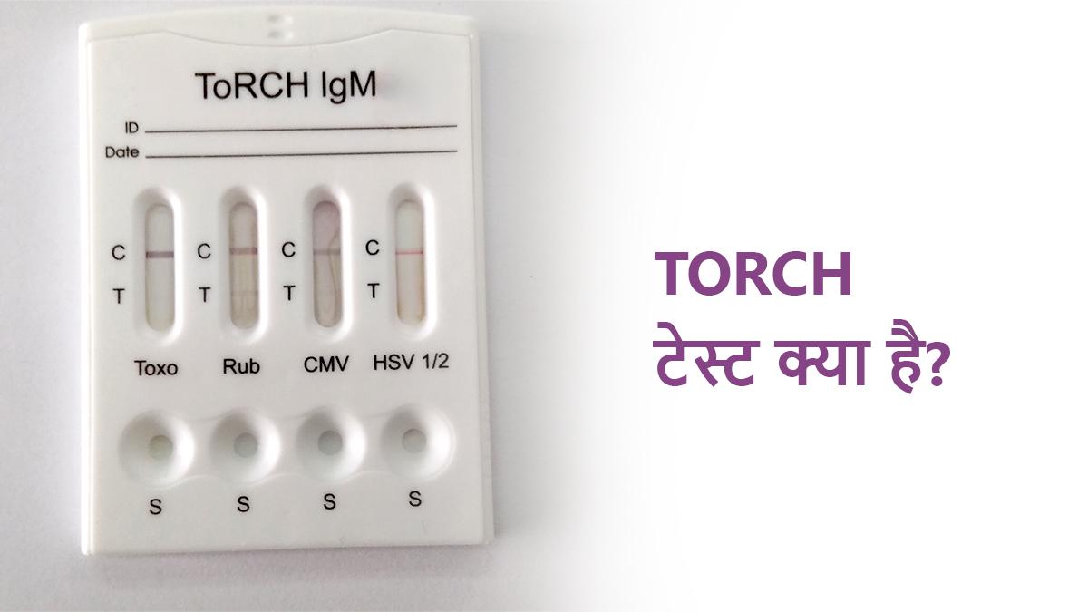 TORCH टेस्ट क्या है? — गर्भावस्था में महत्व, रिपोर्ट और कीमत