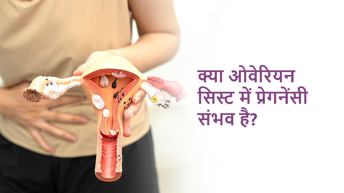 क्या ओवेरियन सिस्ट में प्रेगनेंसी संभव है?