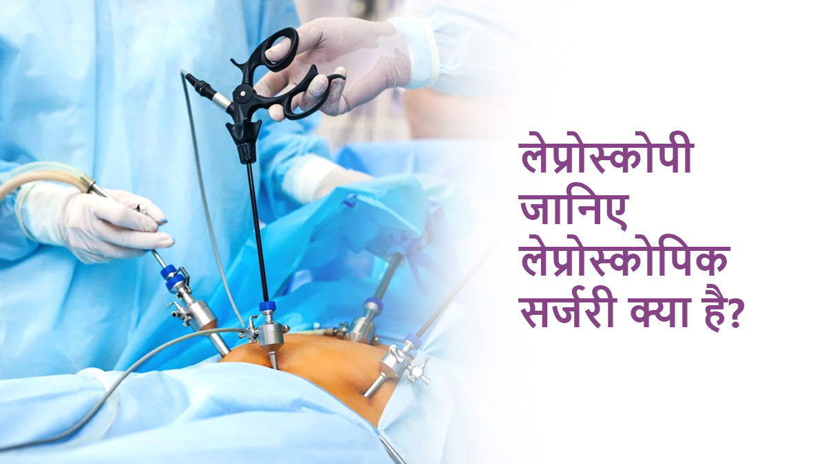 लेप्रोस्कोपी (Laparoscopy Meaning in Hindi): जानिए लेप्रोस्कोपिक सर्जरी क्या है?