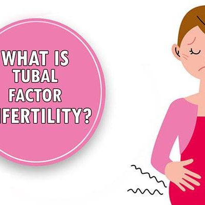 What Do You Need to Know About Tubal Factor Infertility?