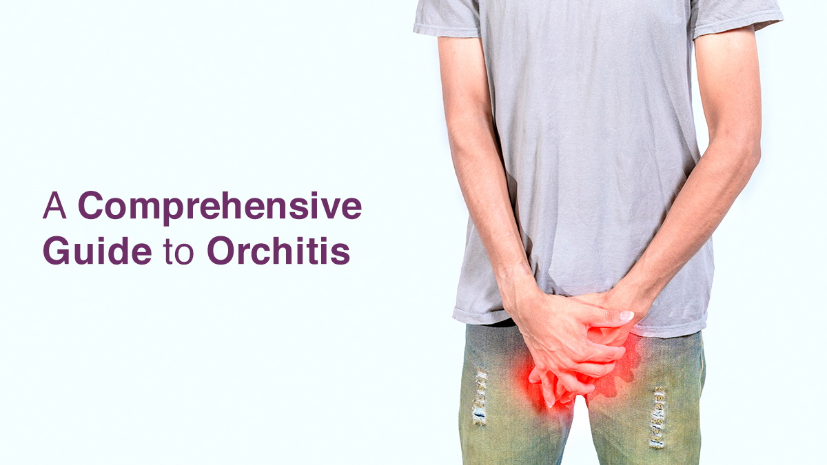 A Comprehensive Guide to Orchitis