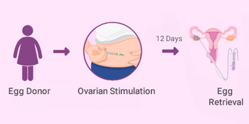 Egg collection process from egg donor