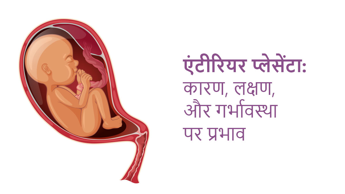 एंटीरियर प्लेसेंटा: कारण, लक्षण, और गर्भावस्था पर प्रभाव