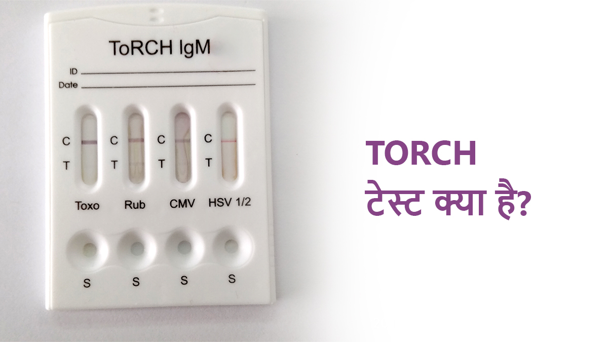 White Discharge Kab Hota Hai? सफ़ेद पानी के कारण, प्रकार और डॉक्टर से कब मिलें
