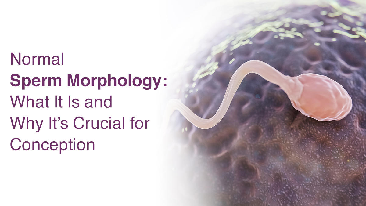 Normal Sperm Morphology: What It Is and Why It’s Crucial for Conception