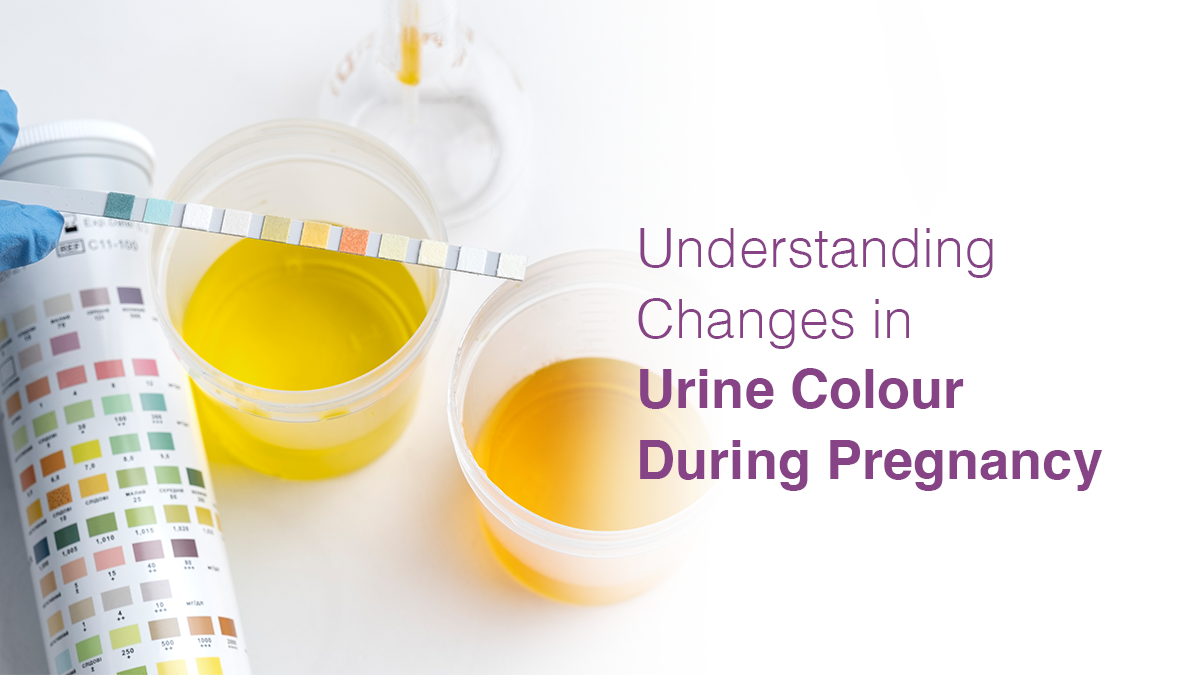 Understanding Changes in Urine Colour During Pregnancy