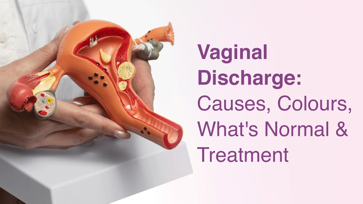 Vaginal Discharge: Causes, Colours, What’s Normal & Treatment