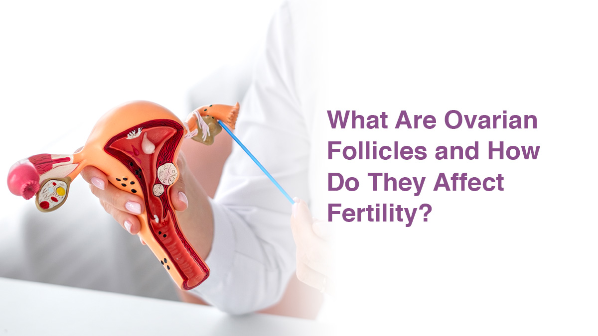What Are Ovarian Follicles and How Do They Affect Fertility?
