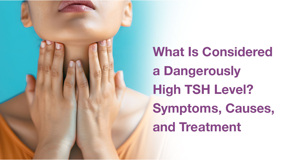 What Is Considered a Dangerously High TSH Level? Symptoms, Causes, and Treatment