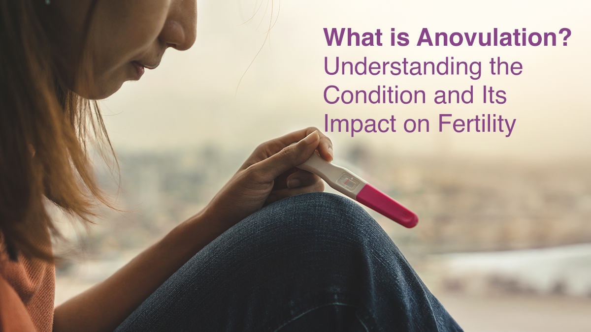 What is Anovulation? Understanding the Condition and Its Impact on Fertility