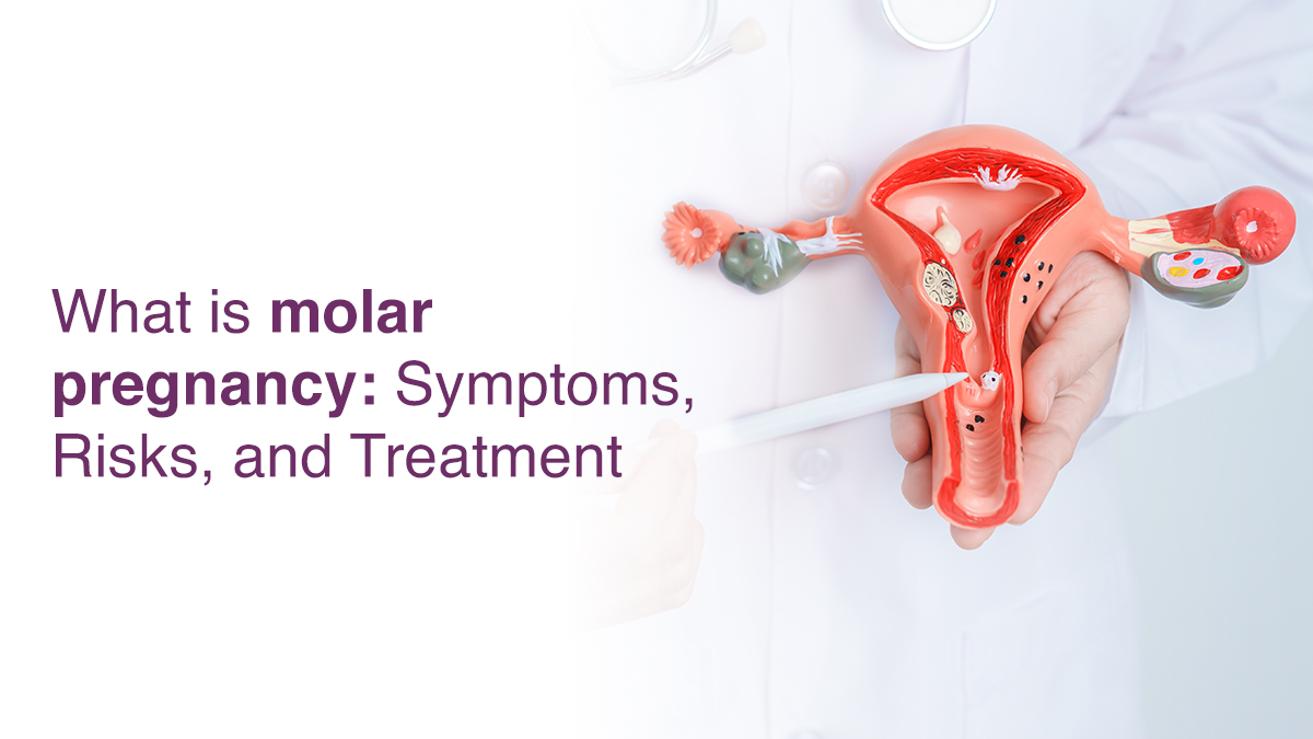 What is Molar Pregnancy: Symptoms, Risks and Treatment
