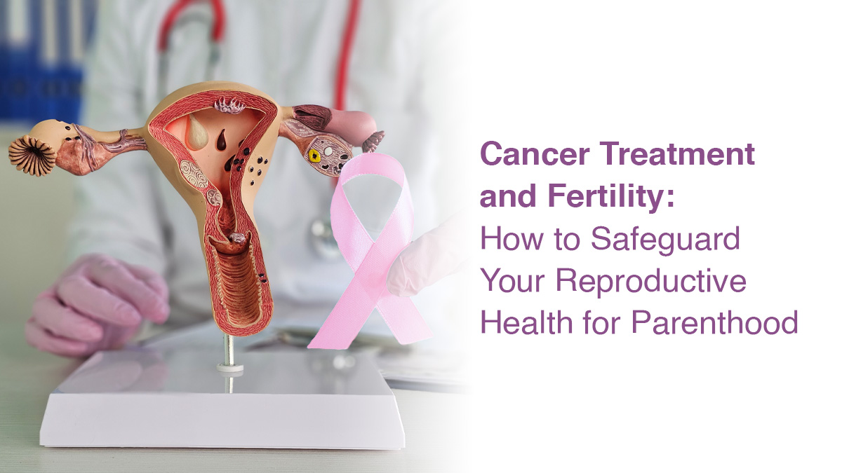 Cancer Treatment and Fertility: How to Safeguard Your Reproductive Health for Parenthood