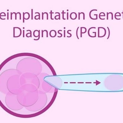 Karyomapping – A Boon For PGD Patients