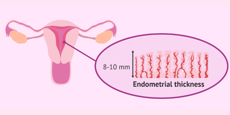 endometrial-thickness-what-you-need-to-know-oasis-fertility