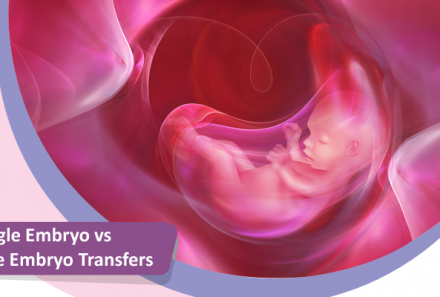 Single Embryo vs Multiple Embryo Transfers