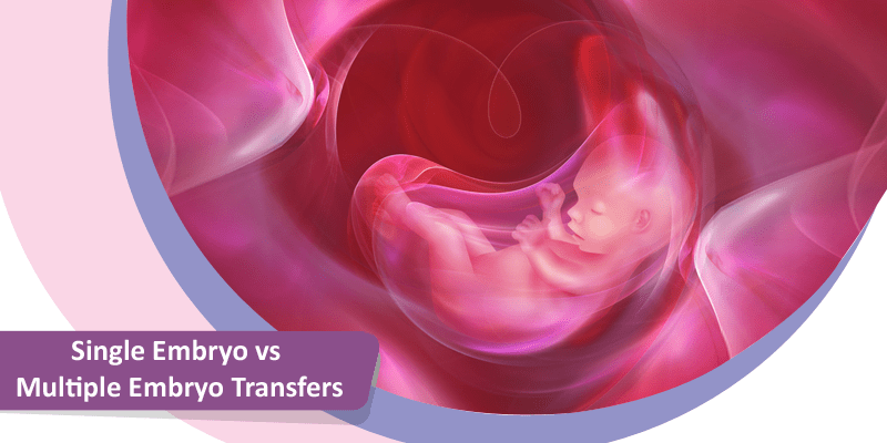 Single Embryo vs Multiple Embryo Transfers