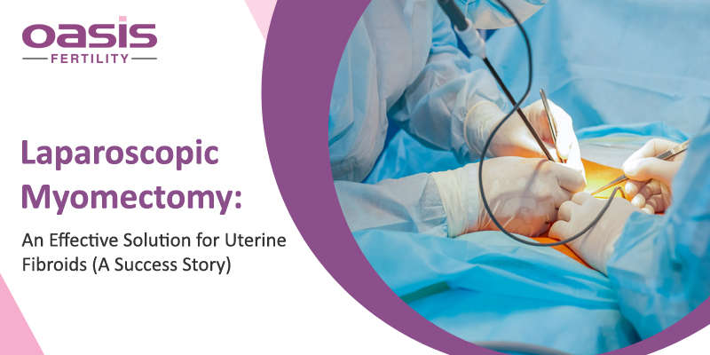 Laparoscopic Myomectomy