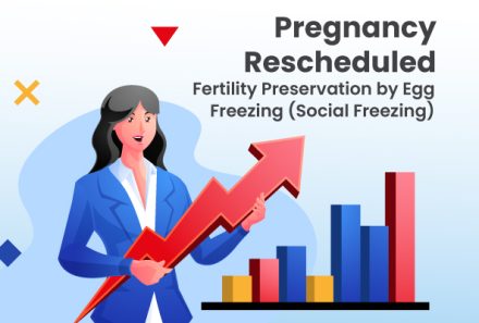Pregnancy Rescheduled – Fertility Preservation by Egg Freezing (Social Freezing)