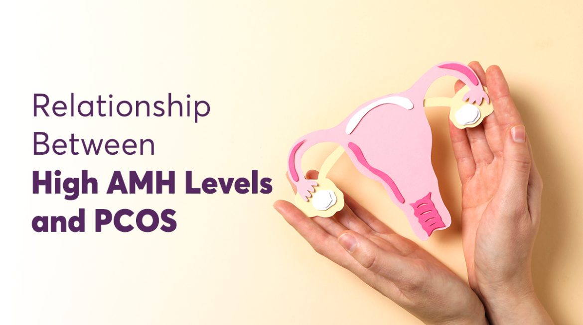 Relationship Between High AMH Levels and PCOS 