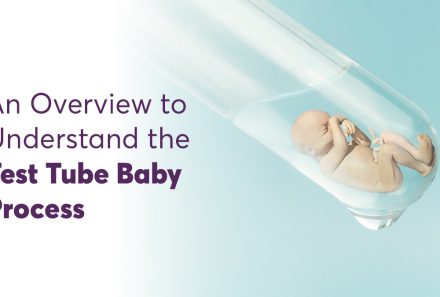 An Overview to Understand the Test Tube Baby Process