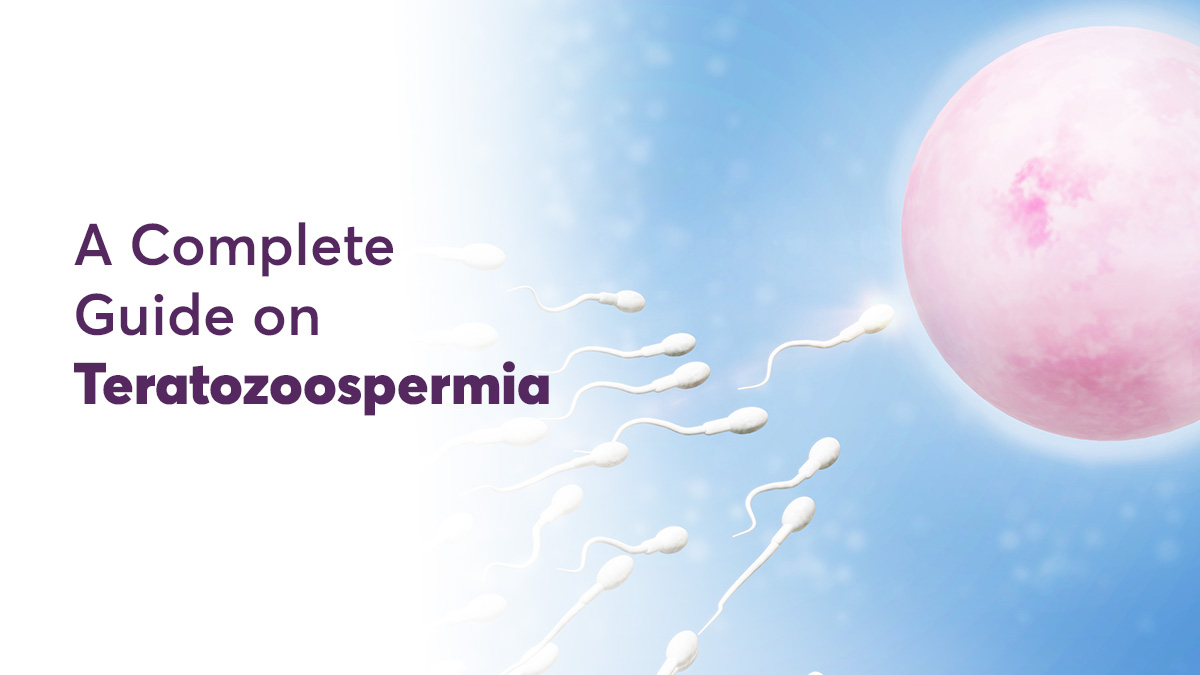 Teratozoospermia: Types, Causes, Symptoms & Treatment