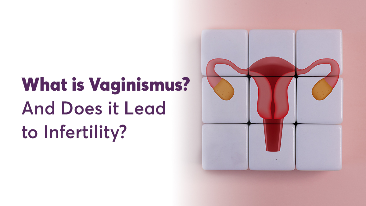 Understanding Vaginismus Causes Symptoms and Treatment Options