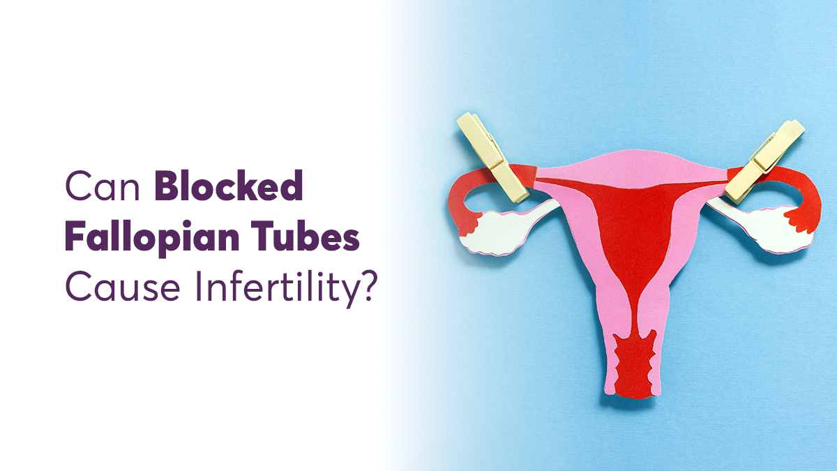 Blocked Fallopian Tubes and Their Impact on Infertility