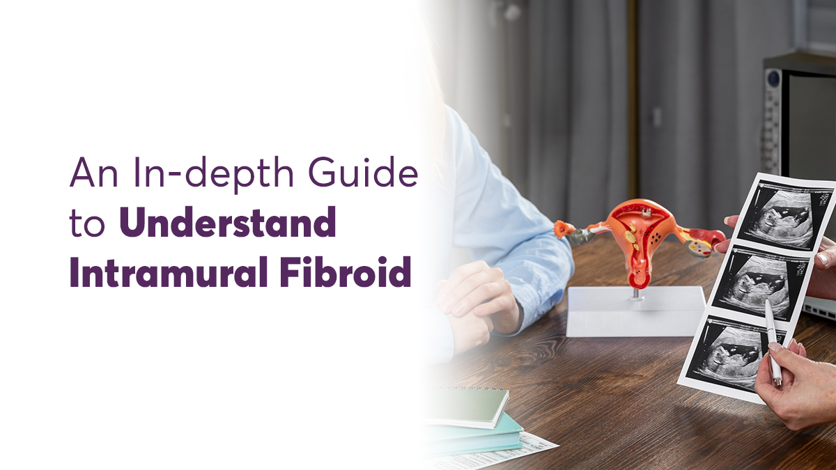 An In-depth Guide to Understanding Intramural Fibroids