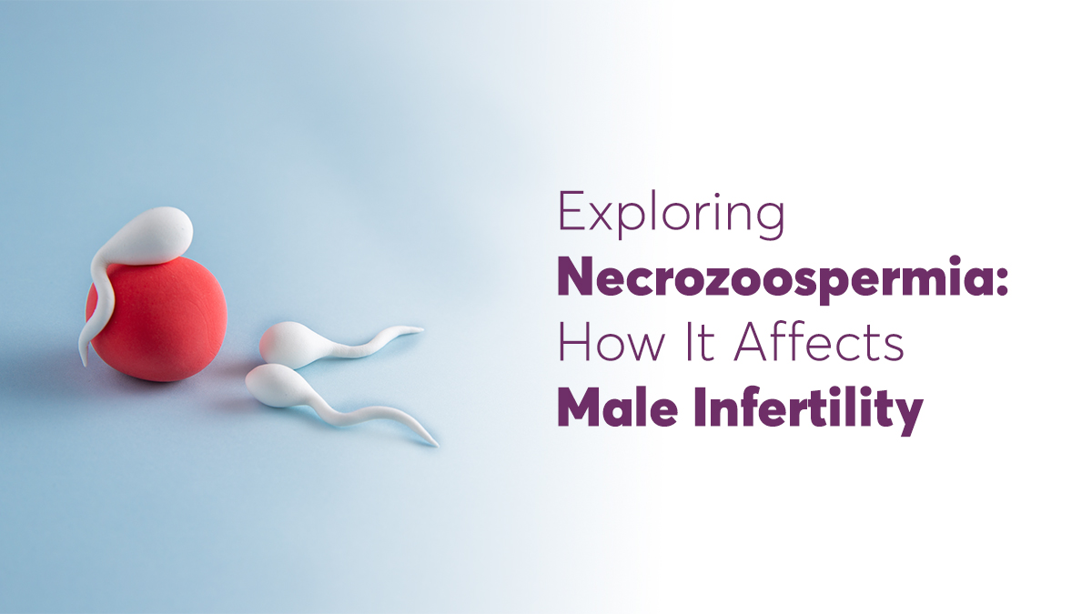 Exploring Necrozoospermia: How It Affects Male Fertility