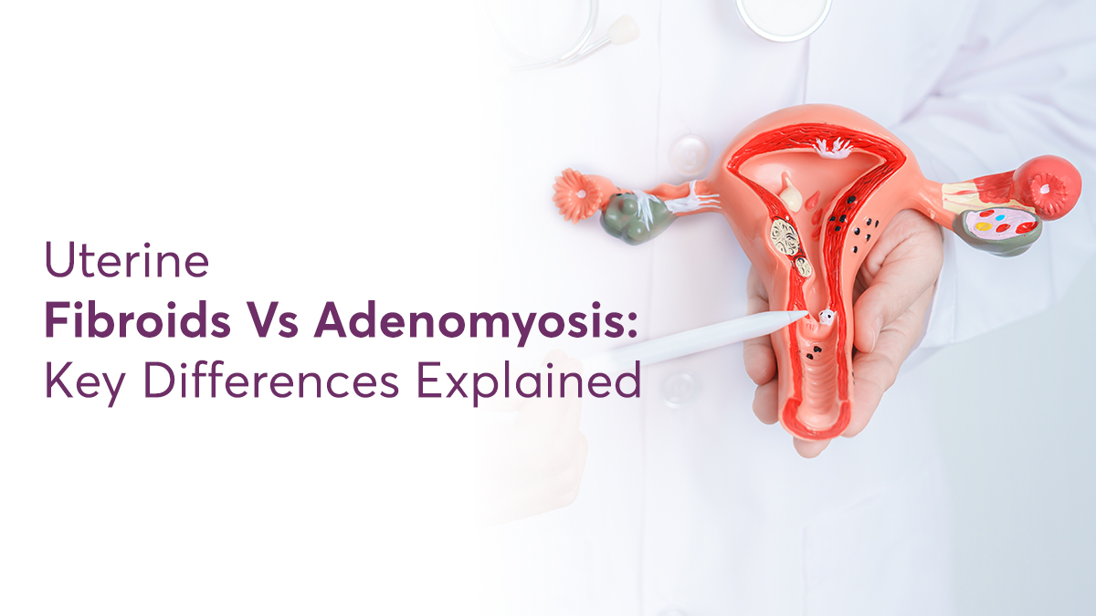 Uterine Fibroids Vs Adenomyosis: Key Differences Explained