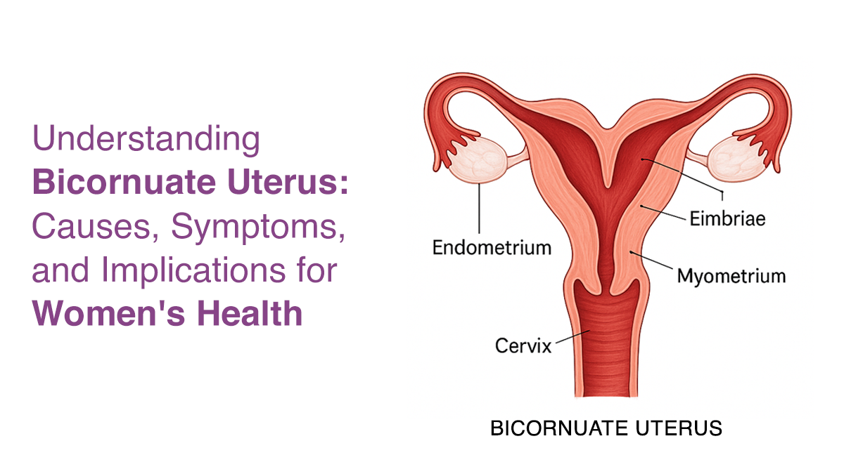 Understanding Bicornuate Uterus: Causes, Symptoms, and Implications for Women’s Health