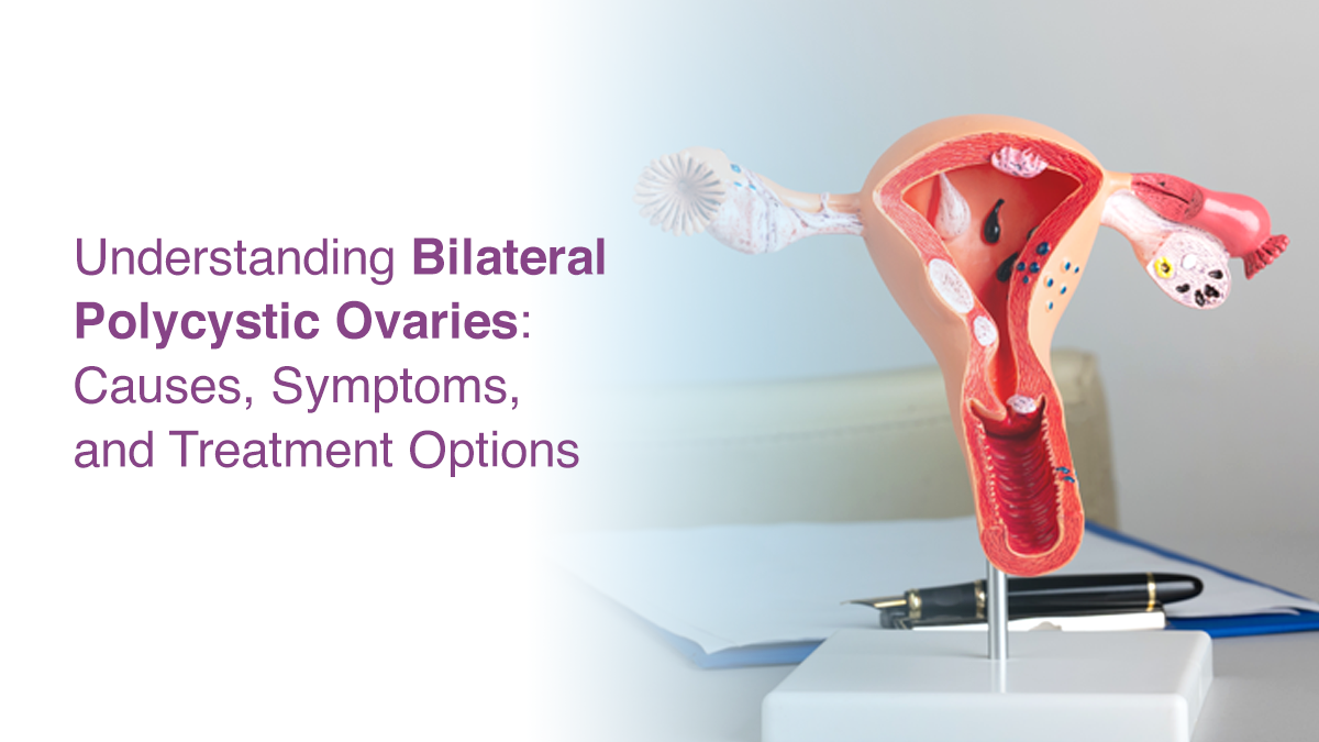 Understanding Bilateral Polycystic Ovaries: Causes, Symptoms, and Treatment Options