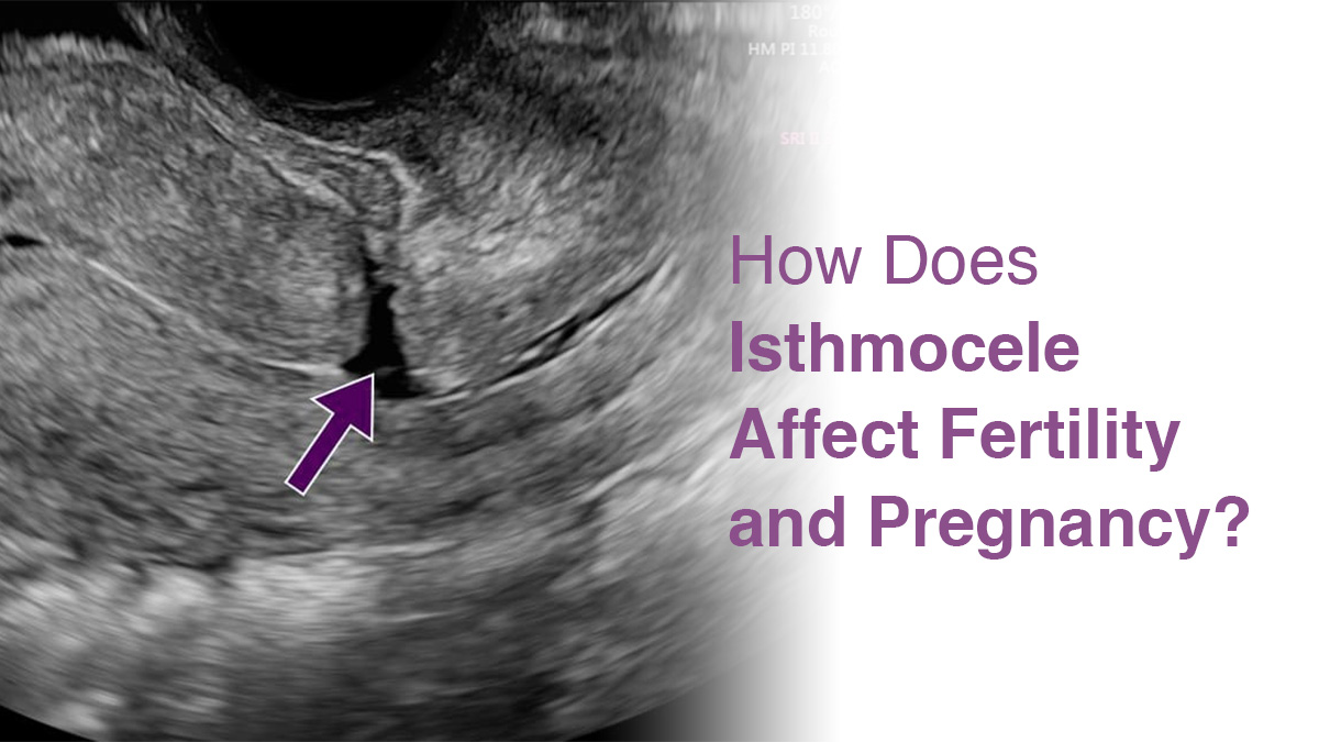 How Does Isthmocele Affect Fertility and Pregnancy?