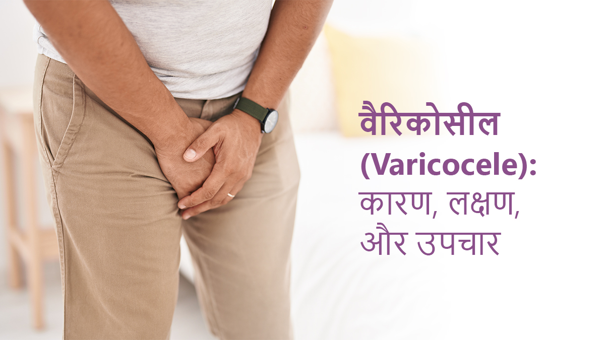 वैरिकोसील (Varicocele): कारण, लक्षण, और उपचार
