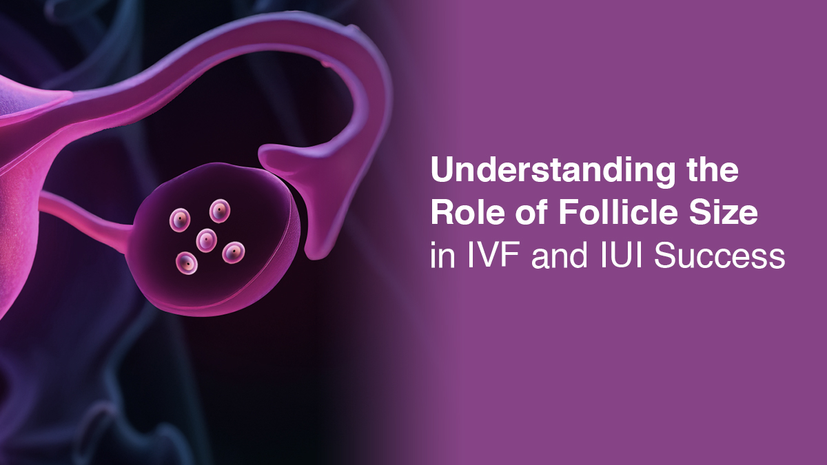 Understanding the Role of Follicle Size in IVF and IUI Success