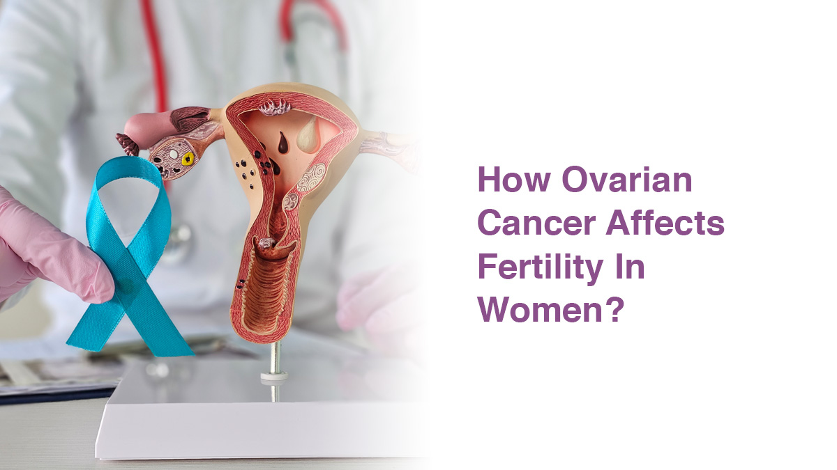 How Does Ovarian Cancer Affect Fertility in Women?