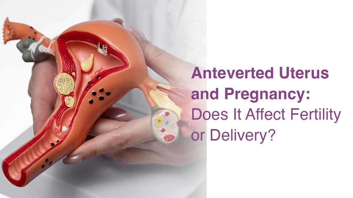 Anteverted Uterus and Pregnancy: Does It Affect Fertility or Delivery?