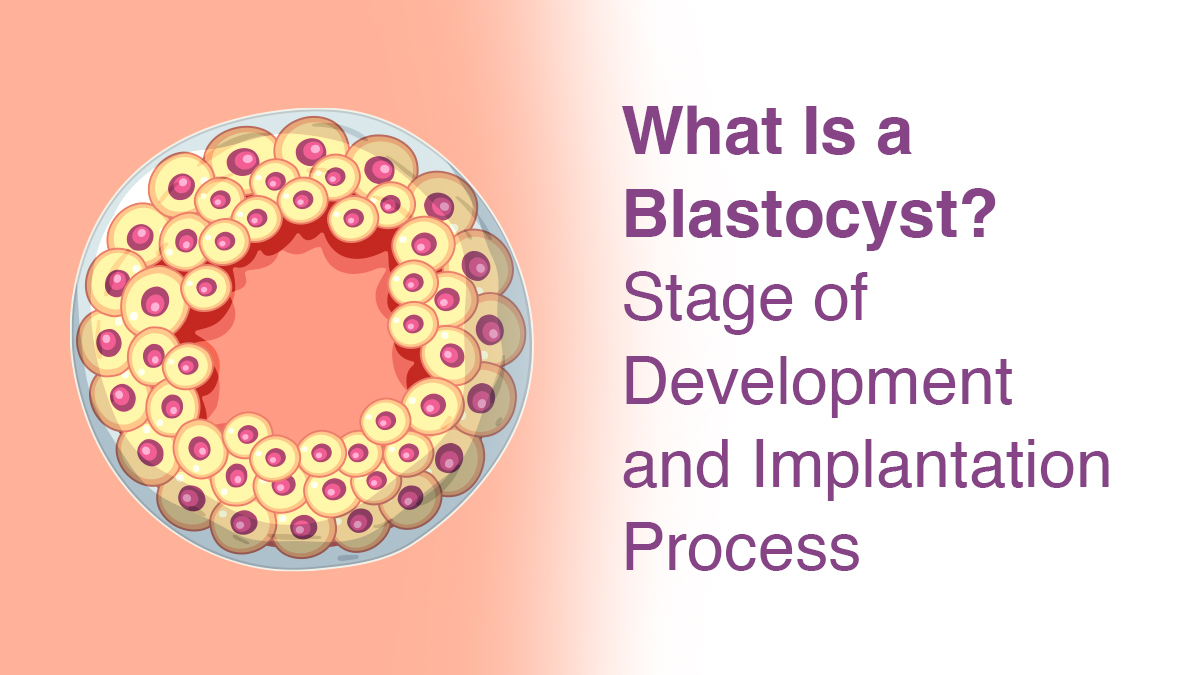What Is a Blastocyst? Stage of Development and Implantation Process