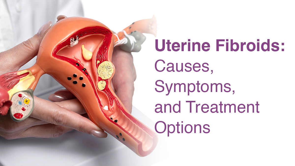 Uterine Fibroids: Causes, Symptoms, and Treatment Options